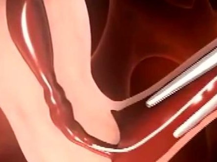 马来西亚试管婴儿，马来西亚三代试管婴儿成功率